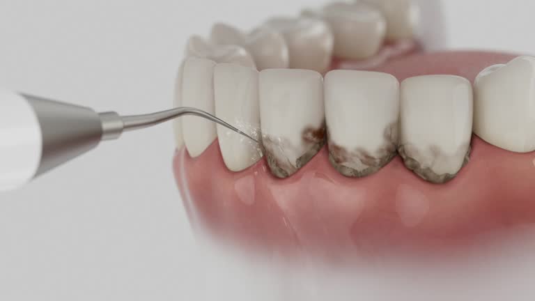Reliable Emergency Dentist contractor in Briar, TX by Smile Center Dentistry